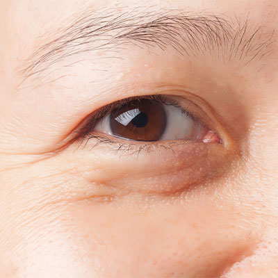 A close-up of a woman's eye.