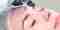 Woman Receiving Microinfusion